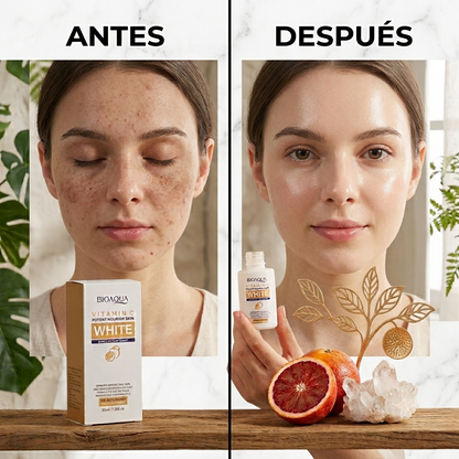 SERUM VITAMINA C